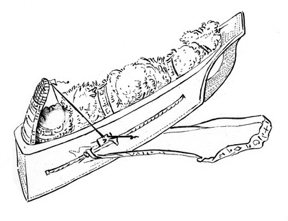 Child in cradle or carrier with contrivance for applying lateral pressure to the skull.