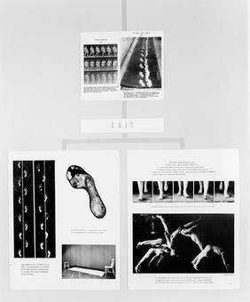 Exhibition '100 Years of medical Photography', 1955.