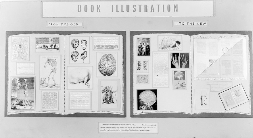 M0014260: Wellcome Historical Medical Museum exhibition: Centenary exhibition of medical photography, 1955: book illustration