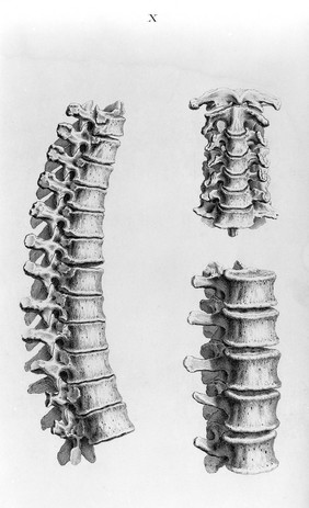 Osteographia, or the anatomy of the bones / [William Cheselden].