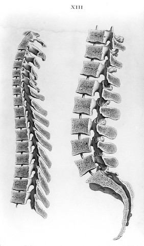 Osteographia, or the anatomy of the bones / [William Cheselden].