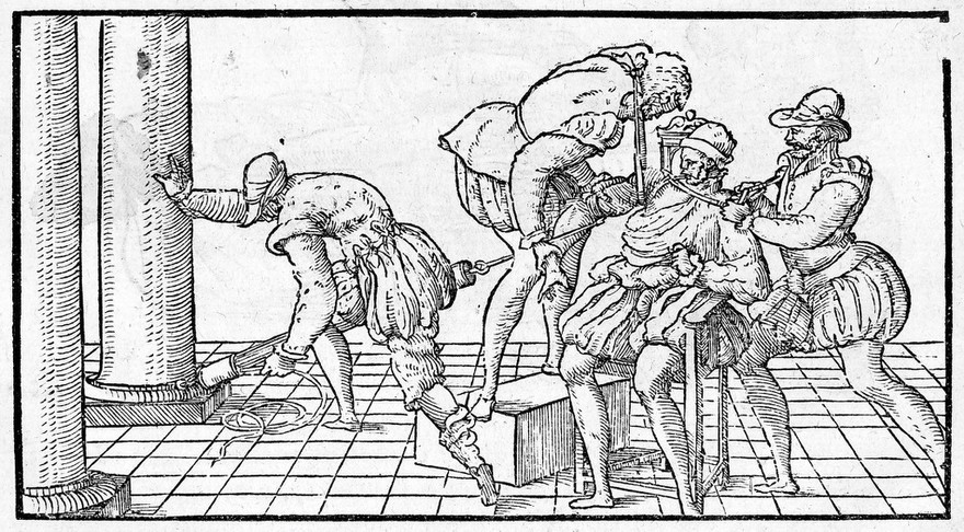 M0014889: Reduction of a dislocated shoulder, 16th century