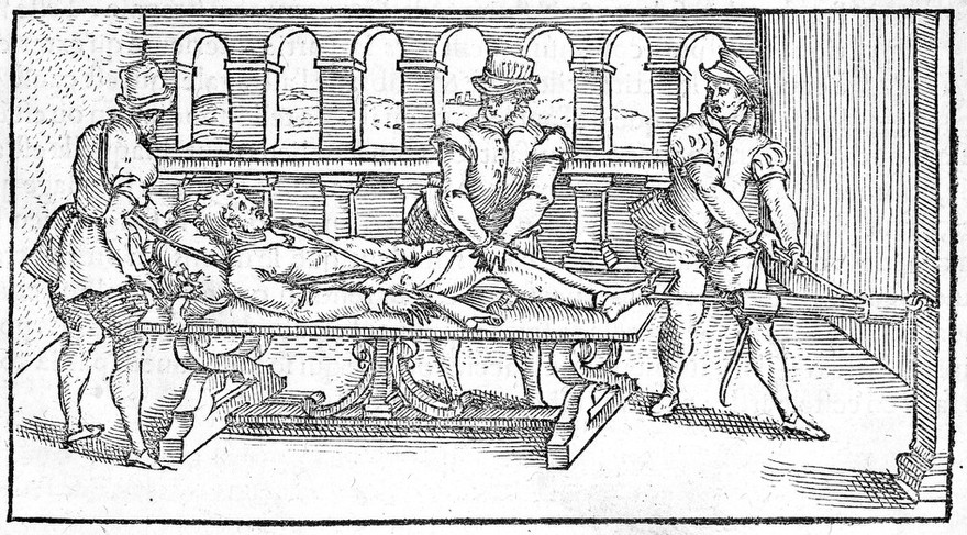 M0014890: Reduction of a dislocated knee, 16th century
