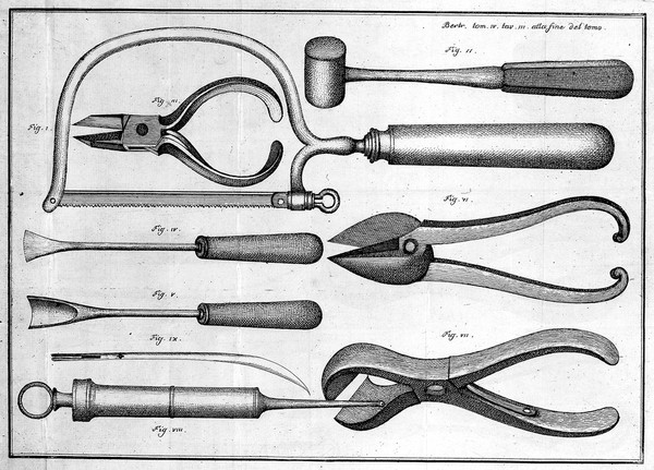 Opere, di Ambrogio Bertrandi / [anatomiche, e cerusiche], pubblicate, e accresciute di note, e di supplementi dai chirurghi Gio. Antonio Penchienati e Gioanni Brugnone.