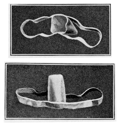 M0015707: Roman prosthetic appliance: side and rear views