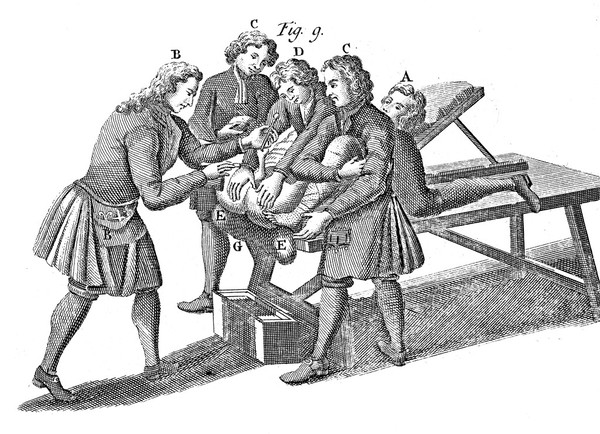 A general system of surgery in three parts : containing the doctrine and management I. of wounds, fractures, luxations, tumours, and ulcers, of all kinds II. of the several operations performed on all parts of the body III. of the several bandages applied in all operations and disorders To which is prefixed an introduction concerning the nature, origin, progress, and improvements of surgery ... / Translated into English. By Lawrence Heister.