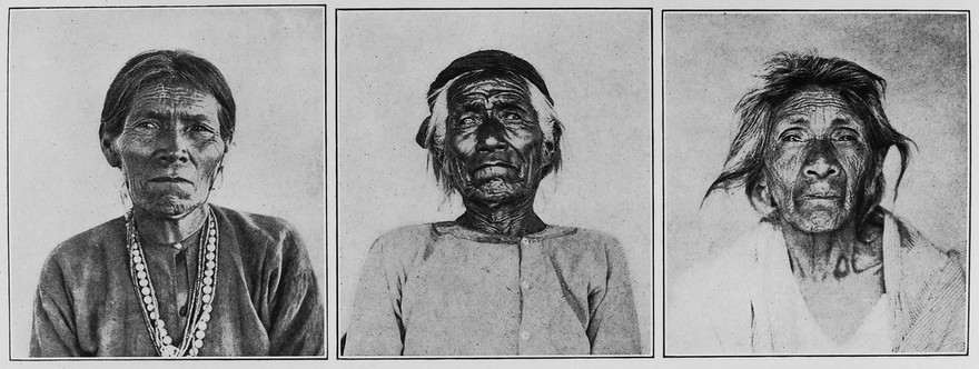 Examples of wrinkling among the Navaho Indians