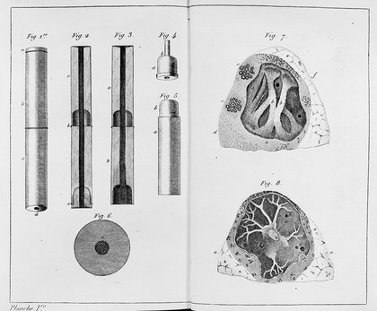 Traité de l'ausculation médiate et des maladies des poumons et du coeur / par R.-T.-H. Laennec.