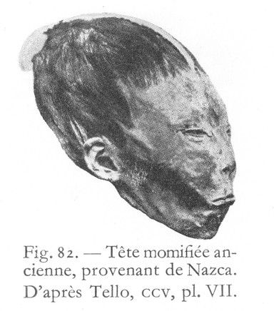 La médecine dans l'ancien Pérou / Raoul d'Harcourt.