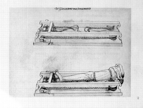 M0016930: Illustration of an arm splint / M0016931: Illustration of apparatus for the correction of dislocations