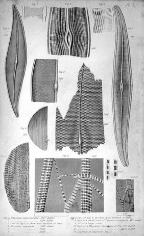 A practical treatise on the use of the microscope, including the different methods of preparing and examining animal, vegetable, and mineral structures / by John Quekett.