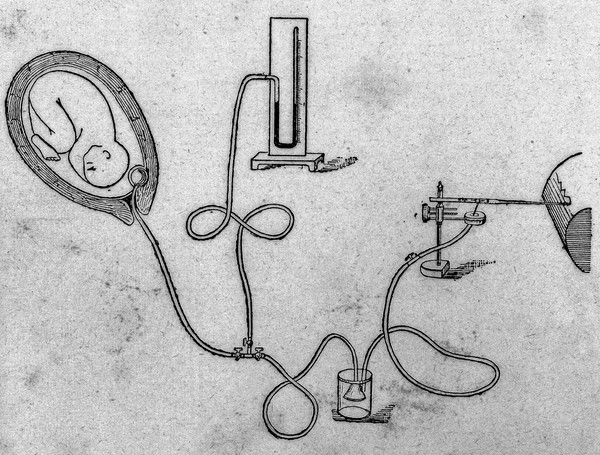M0017673: Illustration of apparatus for studying uterine contractions during childbirth