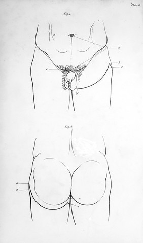 On gun-shot wounds of the extremities, requiring the different operations of amputation, with their after-treatment : establishing the advantages of amputation on the field of battle to the delay usually recommended ... / by G.J. Guthrie.