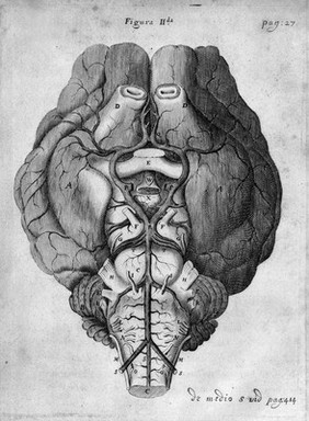 Showing the circle of Willis