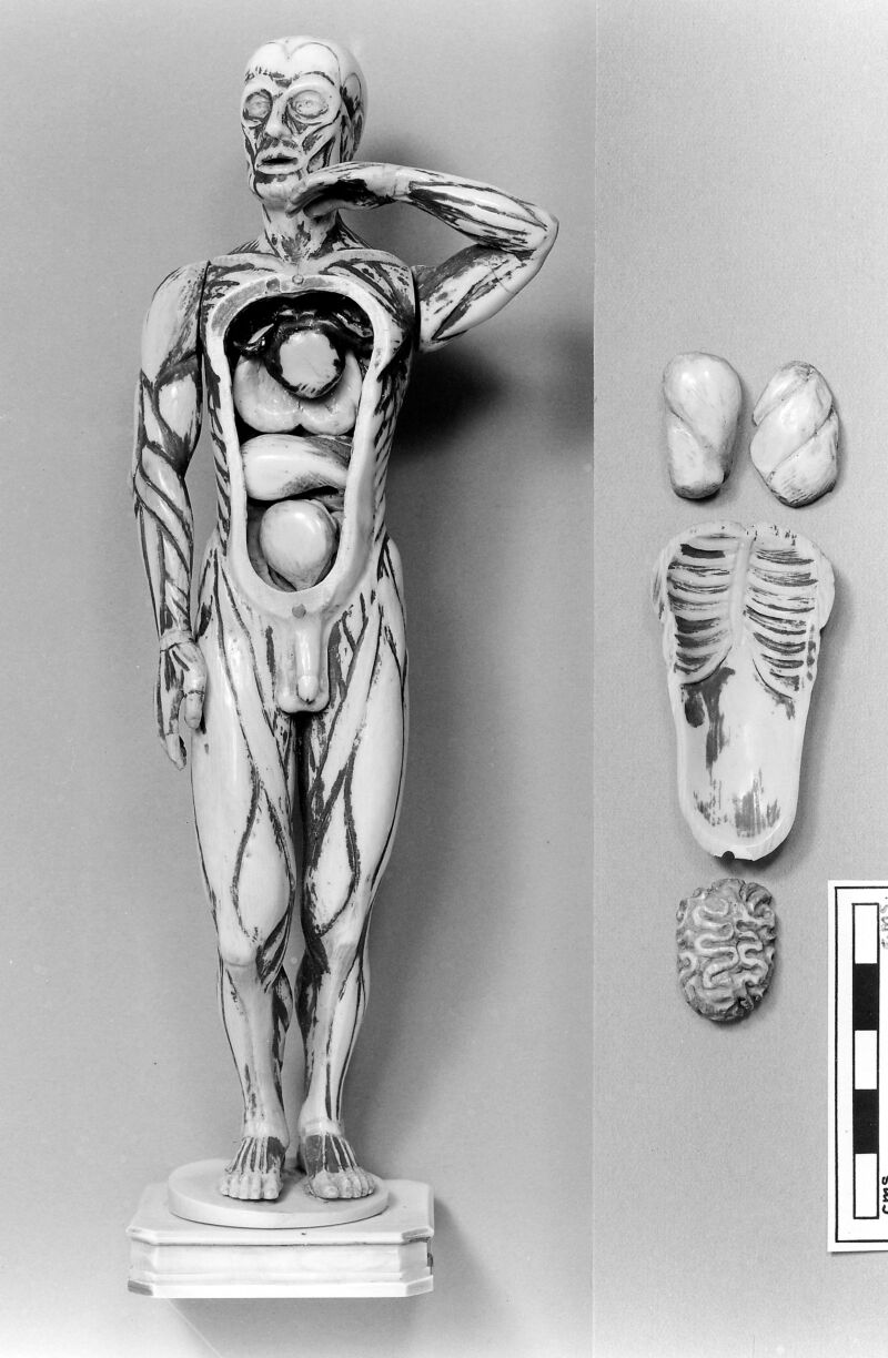 No text description is available for this image