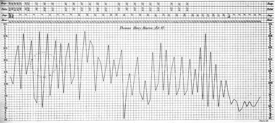 Temperature chart of a case of tuberculosis