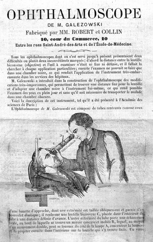 view The ophthalmoscope designed by Xavier Galezowski.