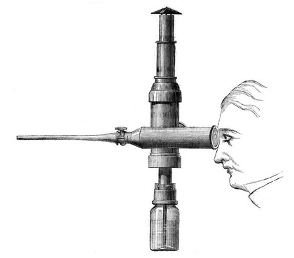 M0018940: Illustration of Desormeaux's endoscope in use, 1865