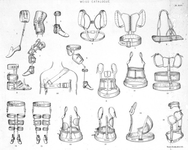 Apparatus for correction of orthopaedic deformity, 19th c.
