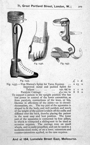 view Orthopaedic instruments, 19th century.