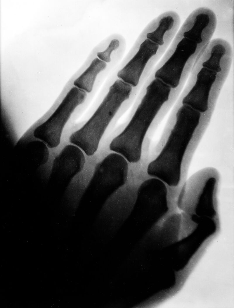 No text description is available for this image