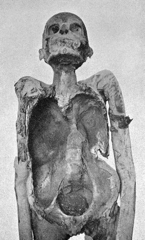 Anterior aspect of the mummy of a priest.