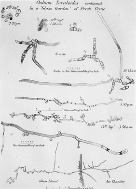 The growth of Oidium Toruloides observed by Lister in a "Glass Garden" of fresh urine