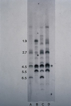 Allergy research, autoradiograph, DNA