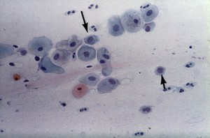 view Parabasal cells