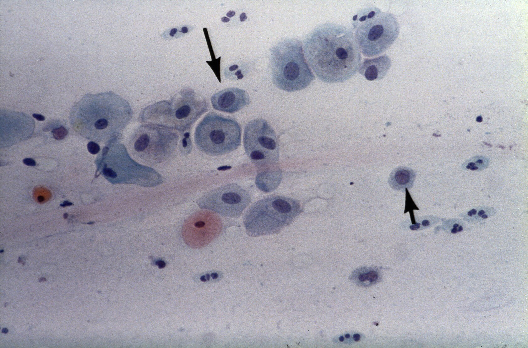 Parabasal cells Collection