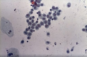 view Histiocytes