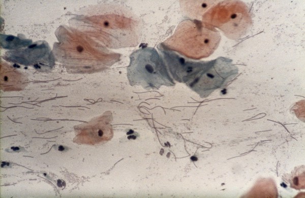 Leptothrix bacteria