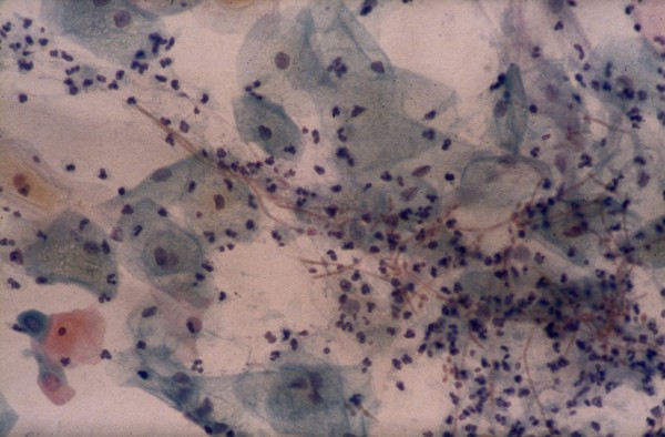 Candida albicans