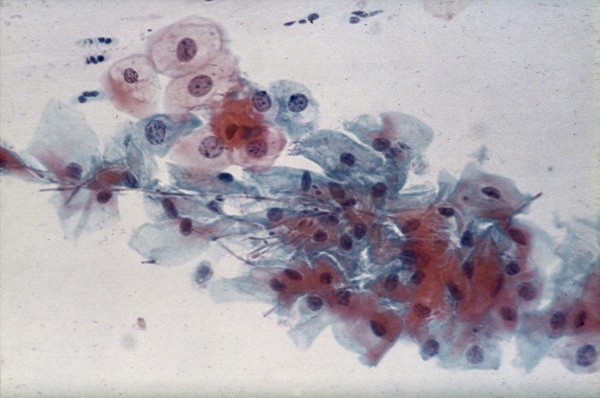 Candida albicans