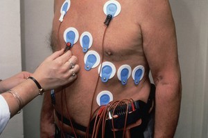 view Electrocardiography, exercise testing