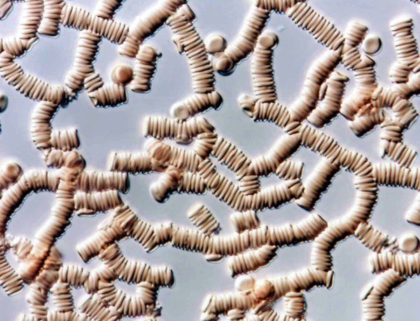 Red blood cells forming rouleaux