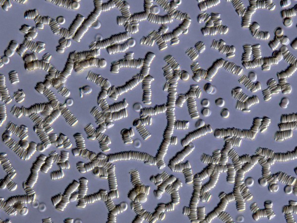 Red blood cells forming rouleaux