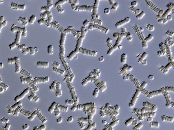 Red blood cells forming rouleaux
