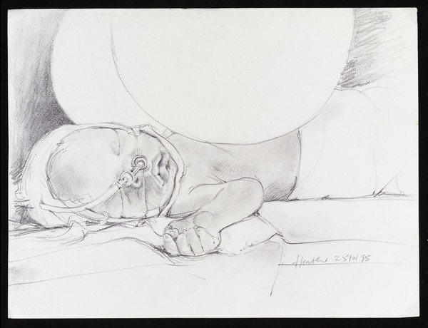Baby in an incubator on nasal CPAP