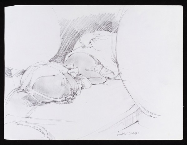 Premature baby on CPAP