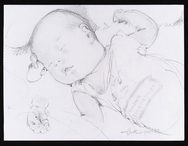 Baby with Down syndrome