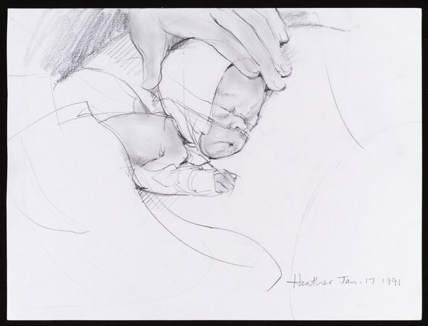 Premature baby in an incubator
