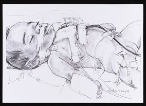 view Premature baby on ECMO