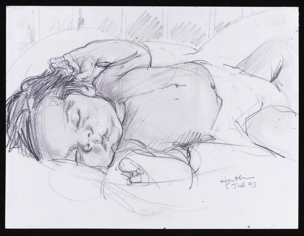 Baby after heart surgery