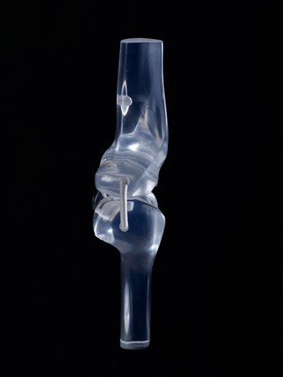 Glass knee
