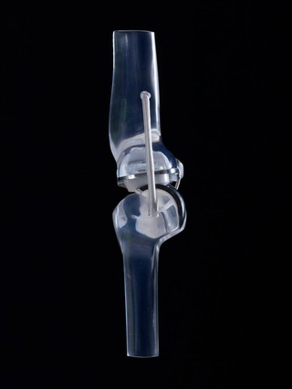Glass knee