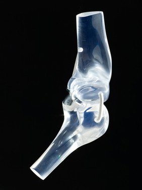 Glass knee