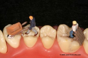 view Tooth maintenance