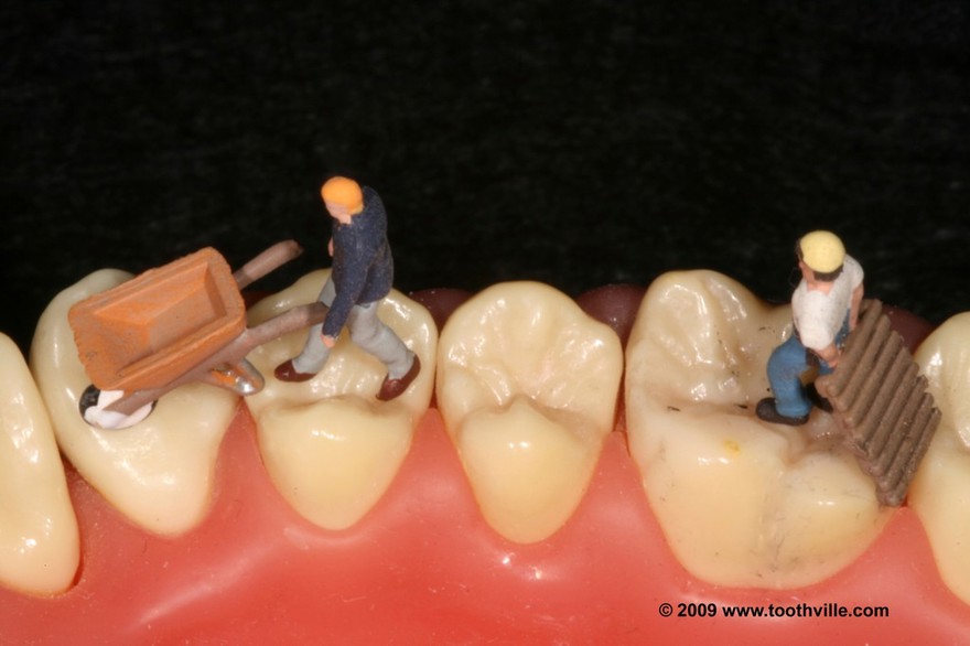 Tooth maintenance