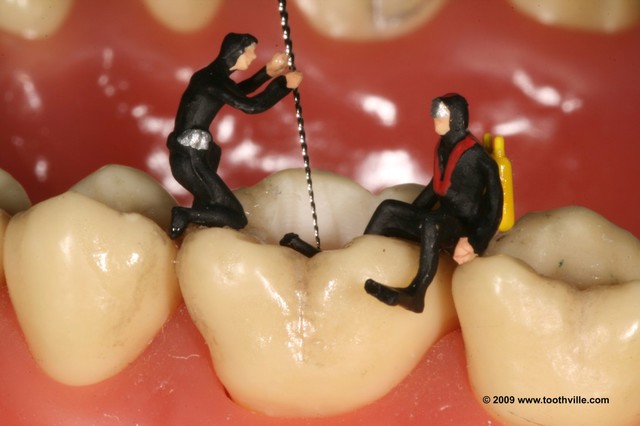 Root canal